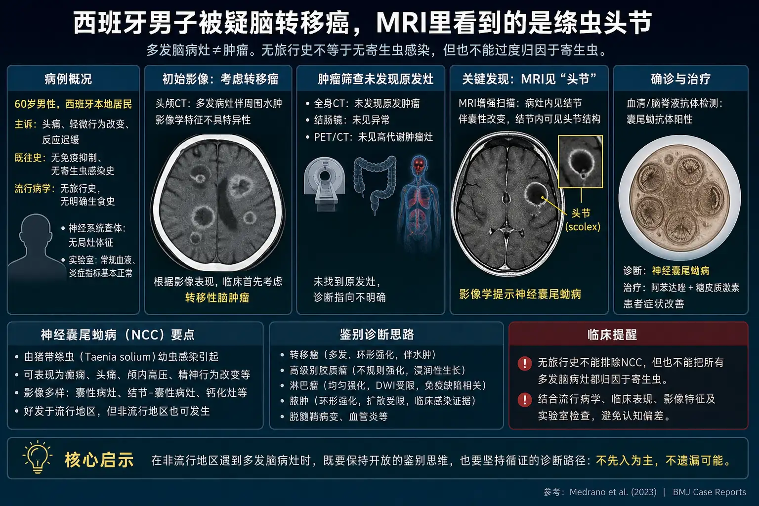 西班牙男子被疑脑转移癌，MRI里看到的是绦虫头节
